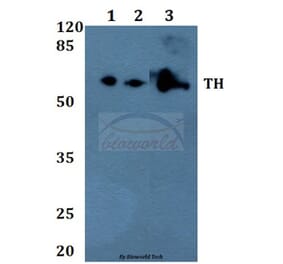 Anti-TH (P2) Antibody from Bioworld Technology (BS1600) - Antibodies.com