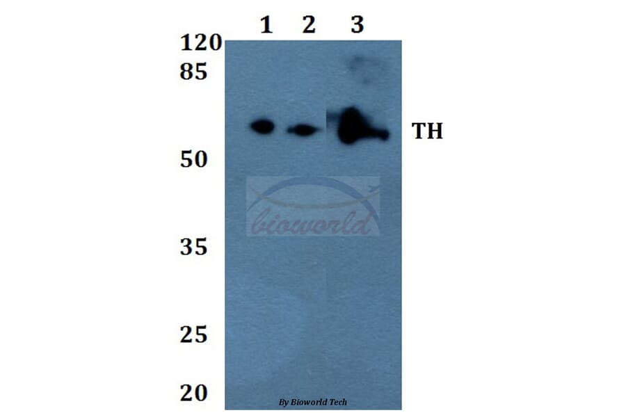 Anti-TH (P2) Antibody from Bioworld Technology (BS1600) - Antibodies.com