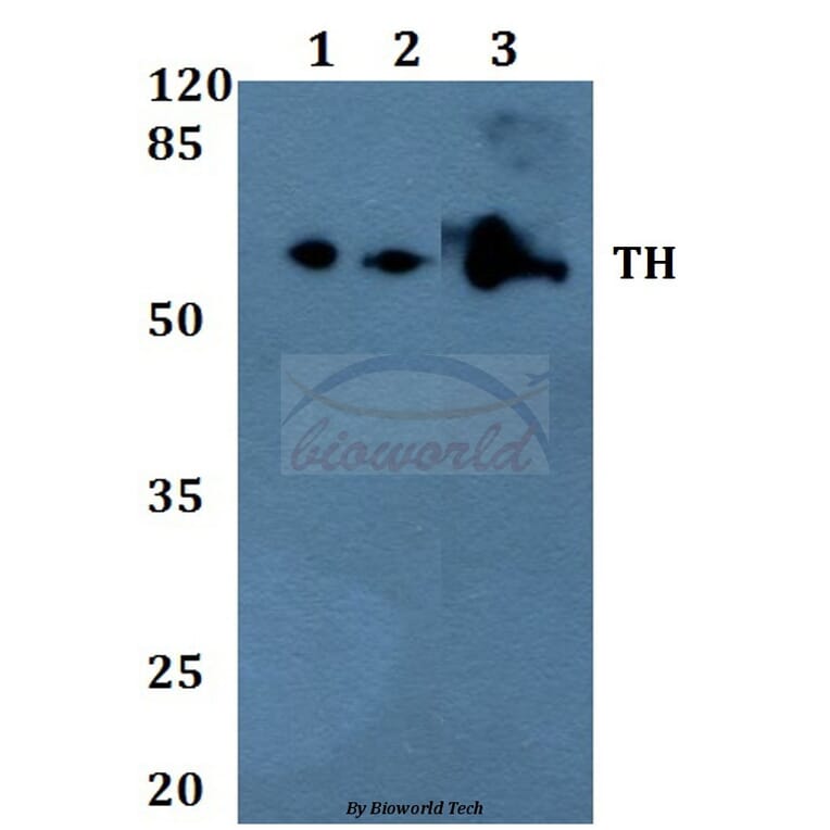 Anti-TH (P2) Antibody from Bioworld Technology (BS1600) - Antibodies.com