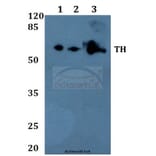 Anti-TH (P2) Antibody from Bioworld Technology (BS1600) - Antibodies.com