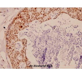 Anti-TK (P7) Antibody from Bioworld Technology (BS1601) - Antibodies.com