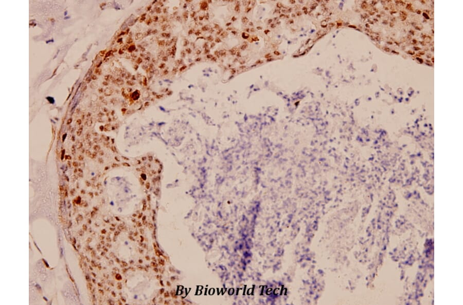 Anti-TK (P7) Antibody from Bioworld Technology (BS1601) - Antibodies.com