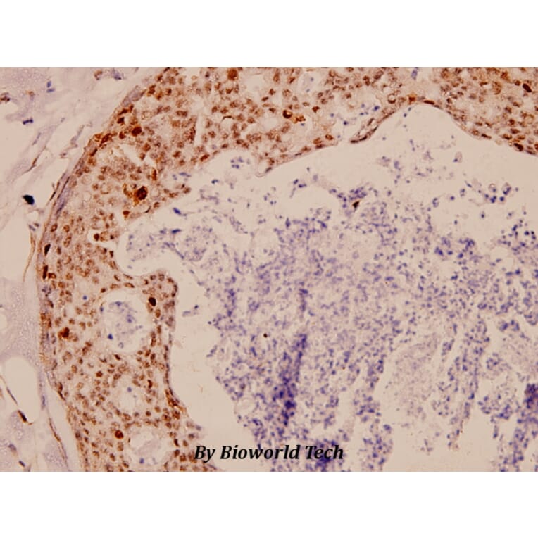 Anti-TK (P7) Antibody from Bioworld Technology (BS1601) - Antibodies.com