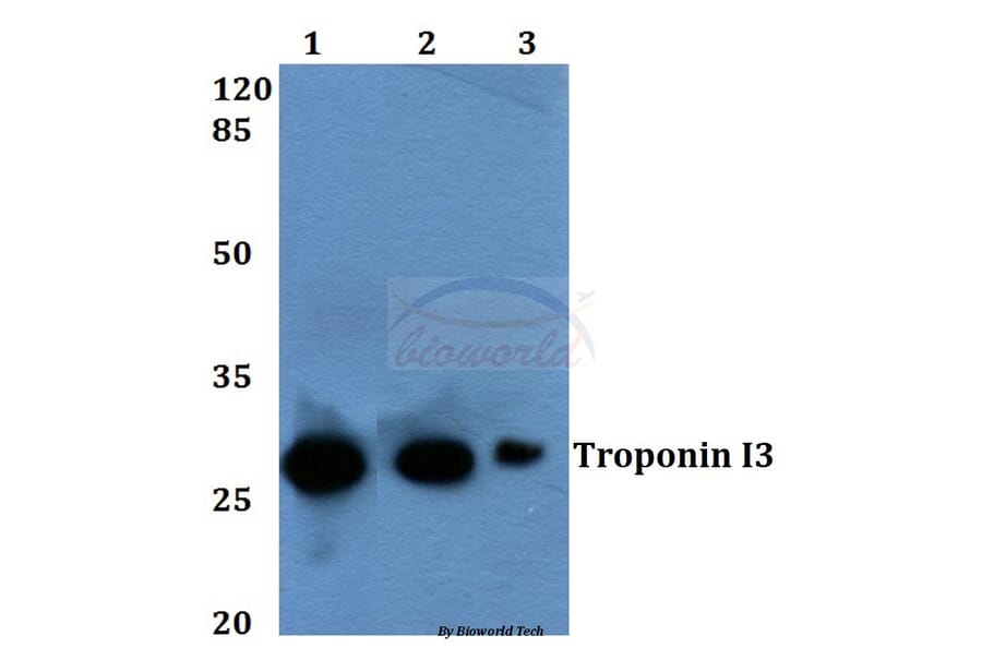 Anti-Troponin I3 (K39) Antibody from Bioworld Technology (BS1602) - Antibodies.com
