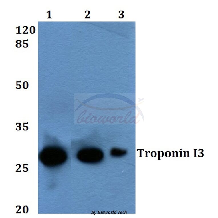 Anti-Troponin I3 (K39) Antibody from Bioworld Technology (BS1602) - Antibodies.com