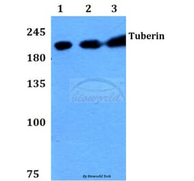 Anti-Tuberin (F933) Antibody from Bioworld Technology (BS1604) - Antibodies.com
