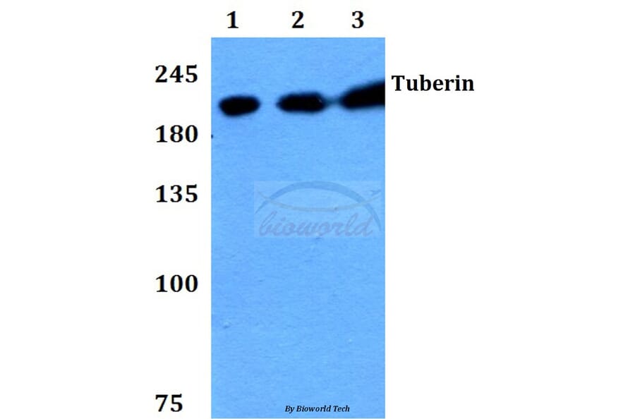 Anti-Tuberin (F933) Antibody from Bioworld Technology (BS1604) - Antibodies.com