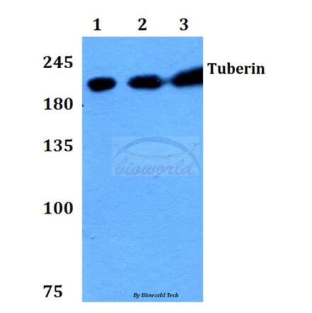 Anti-Tuberin (F933) Antibody from Bioworld Technology (BS1604) - Antibodies.com