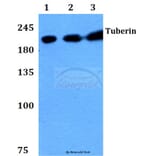 Anti-Tuberin (F933) Antibody from Bioworld Technology (BS1604) - Antibodies.com