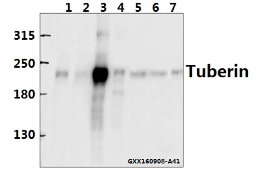 Anti-Tuberin (F933) Antibody from Bioworld Technology (BS1604) - Antibodies.com