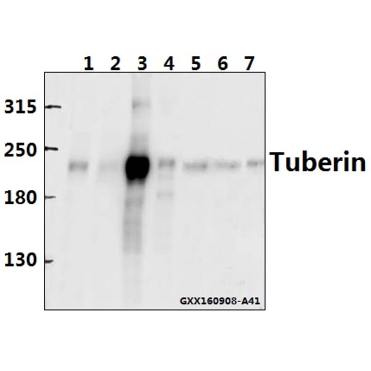 Anti-Tuberin (F933) Antibody from Bioworld Technology (BS1604) - Antibodies.com