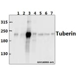 Anti-Tuberin (F933) Antibody from Bioworld Technology (BS1604) - Antibodies.com