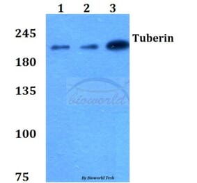 Anti-Tuberin (L1456) Antibody from Bioworld Technology (BS1605) - Antibodies.com