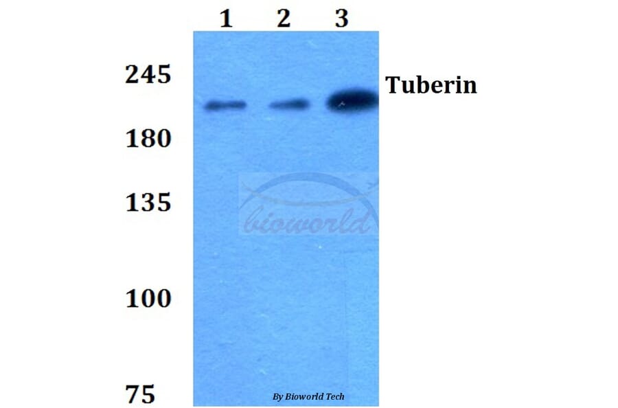 Anti-Tuberin (L1456) Antibody from Bioworld Technology (BS1605) - Antibodies.com