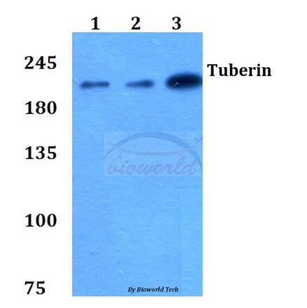 Anti-Tuberin (L1456) Antibody from Bioworld Technology (BS1605) - Antibodies.com