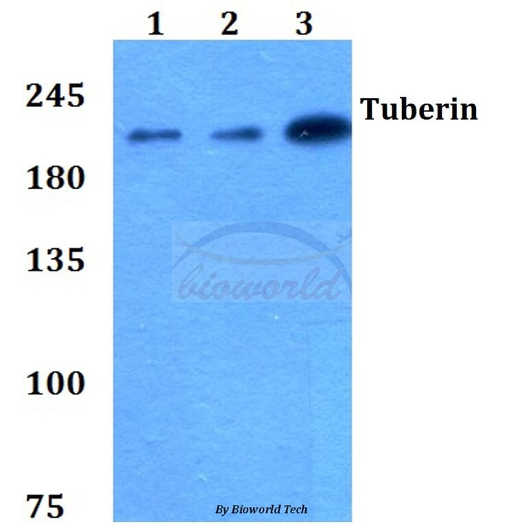 Anti-Tuberin (L1456) Antibody from Bioworld Technology (BS1605) - Antibodies.com