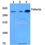 Anti-Tuberin (L1456) Antibody from Bioworld Technology (BS1605) - Antibodies.com