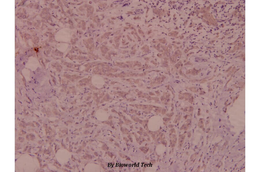 Anti-Tuberin (L1456) Antibody from Bioworld Technology (BS1605) - Antibodies.com