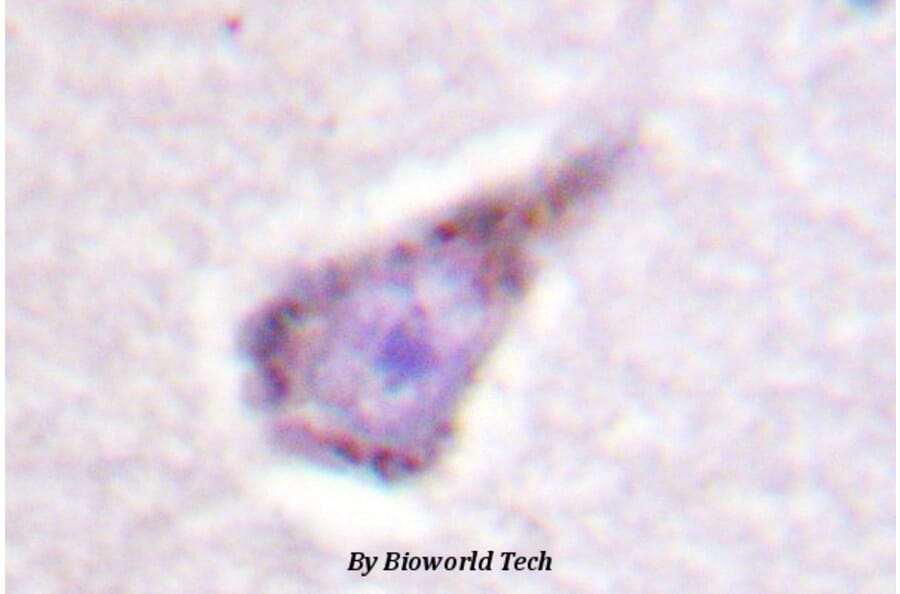 Anti-WASP (E284) Antibody from Bioworld Technology (BS1607) - Antibodies.com