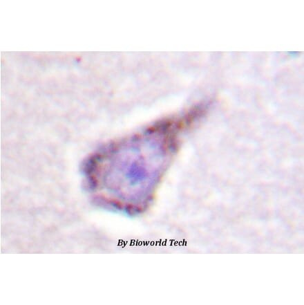 Anti-WASP (E284) Antibody from Bioworld Technology (BS1607) - Antibodies.com