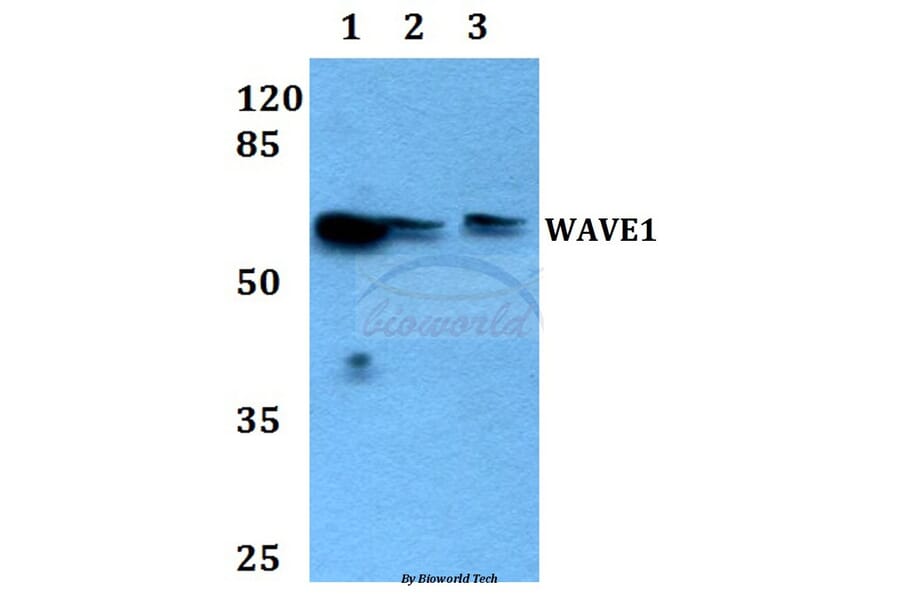 Anti-WAVE1 (I119) Antibody from Bioworld Technology (BS1608) - Antibodies.com
