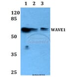 Anti-WAVE1 (I119) Antibody from Bioworld Technology (BS1608) - Antibodies.com