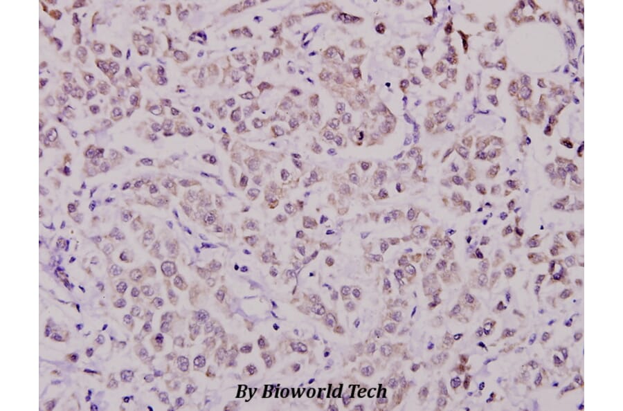 Anti-WAVE1 (I119) Antibody from Bioworld Technology (BS1608) - Antibodies.com