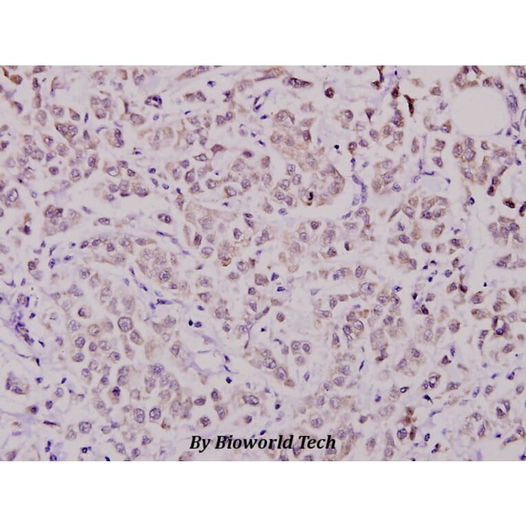 Anti-WAVE1 (I119) Antibody from Bioworld Technology (BS1608) - Antibodies.com