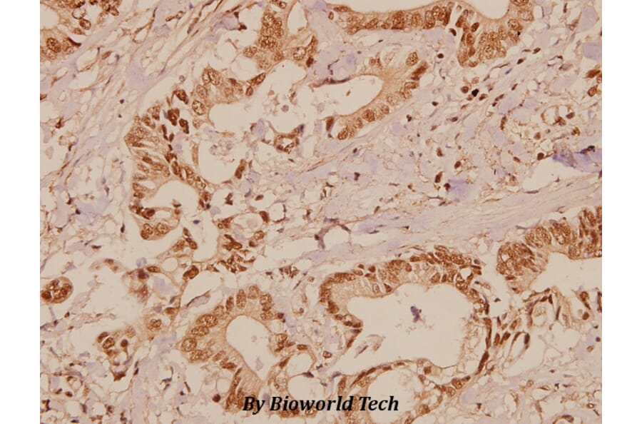Anti-Raf-1 (Q39) Antibody from Bioworld Technology (BS1622) - Antibodies.com