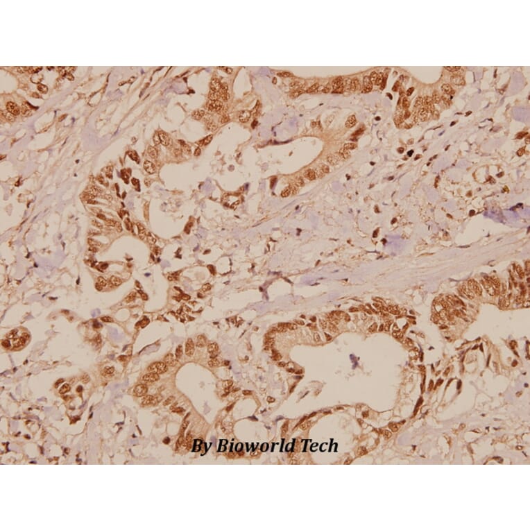 Anti-Raf-1 (Q39) Antibody from Bioworld Technology (BS1622) - Antibodies.com