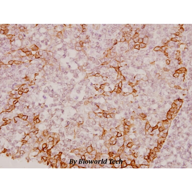 Anti-CREB (V115) Antibody from Bioworld Technology (BS1624) - Antibodies.com