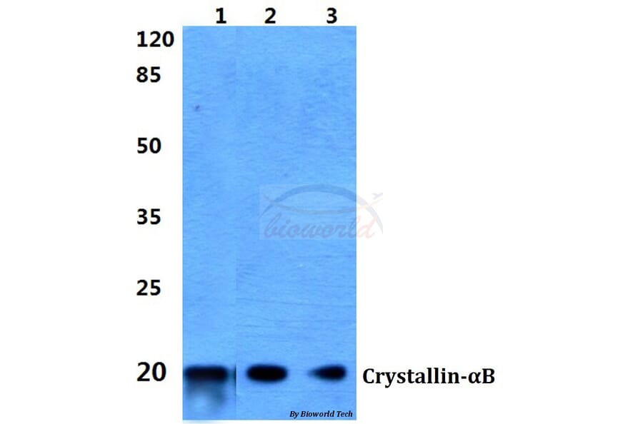 Anti-Crystallin-αB (L55) Antibody from Bioworld Technology (BS1626) - Antibodies.com