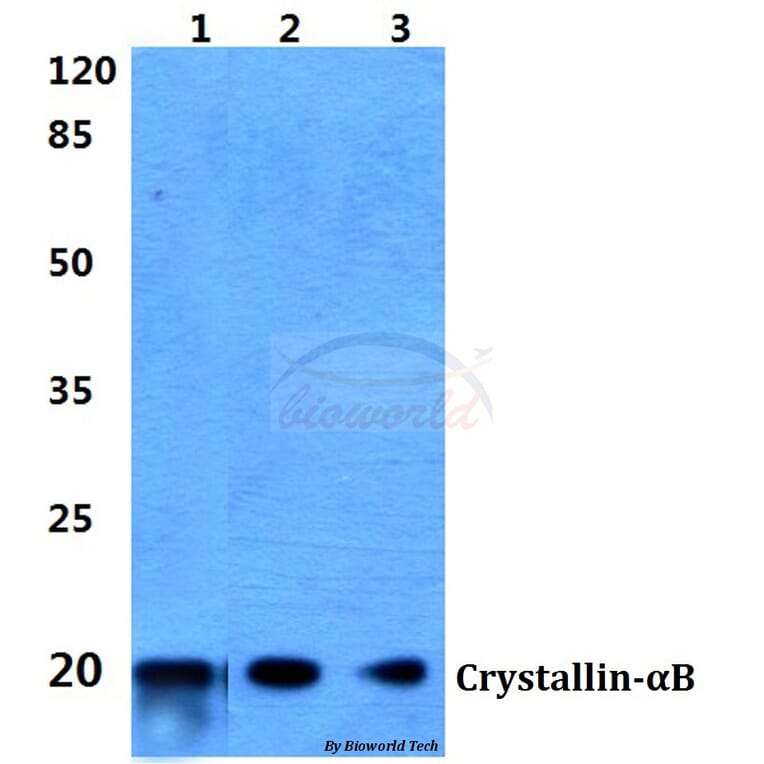Anti-Crystallin-αB (L55) Antibody from Bioworld Technology (BS1626) - Antibodies.com