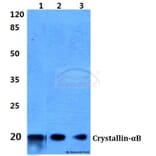 Anti-Crystallin-αB (L55) Antibody from Bioworld Technology (BS1626) - Antibodies.com
