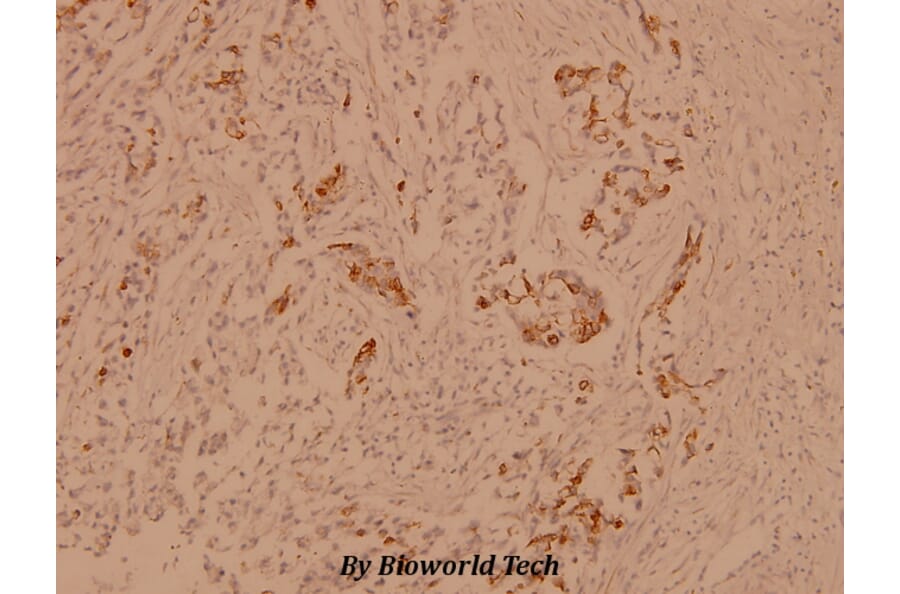 Anti-Crystallin-αB (L55) Antibody from Bioworld Technology (BS1626) - Antibodies.com
