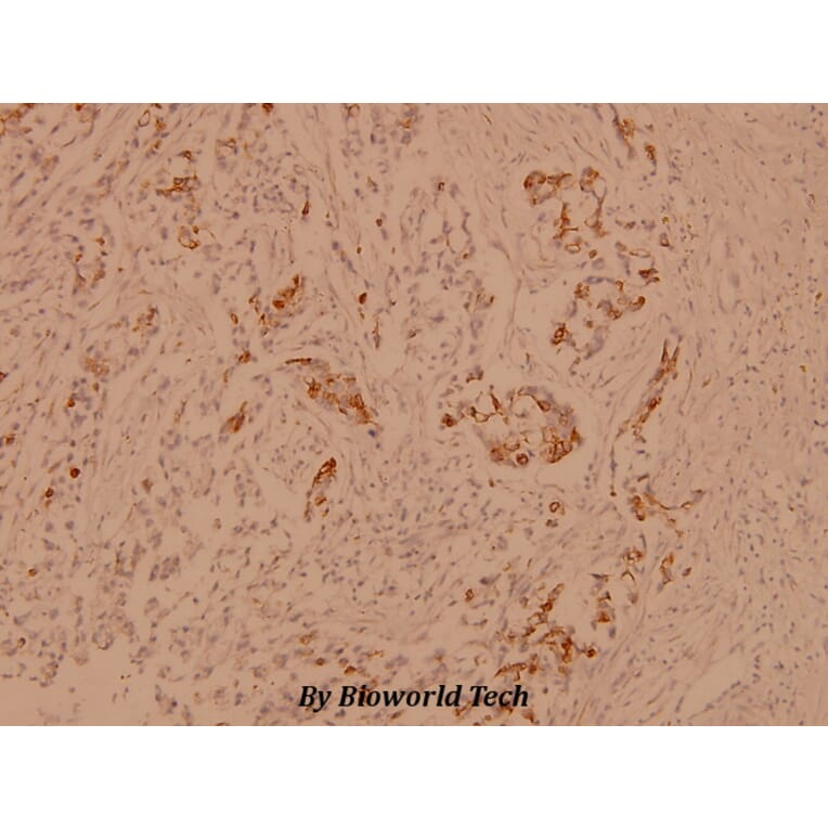 Anti-Crystallin-αB (L55) Antibody from Bioworld Technology (BS1626) - Antibodies.com