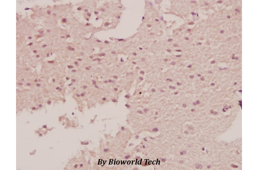 Anti-c-Fms (E557) Antibody from Bioworld Technology (BS1627) - Antibodies.com
