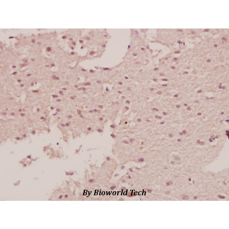 Anti-c-Fms (E557) Antibody from Bioworld Technology (BS1627) - Antibodies.com