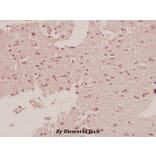 Anti-c-Fms (E557) Antibody from Bioworld Technology (BS1627) - Antibodies.com
