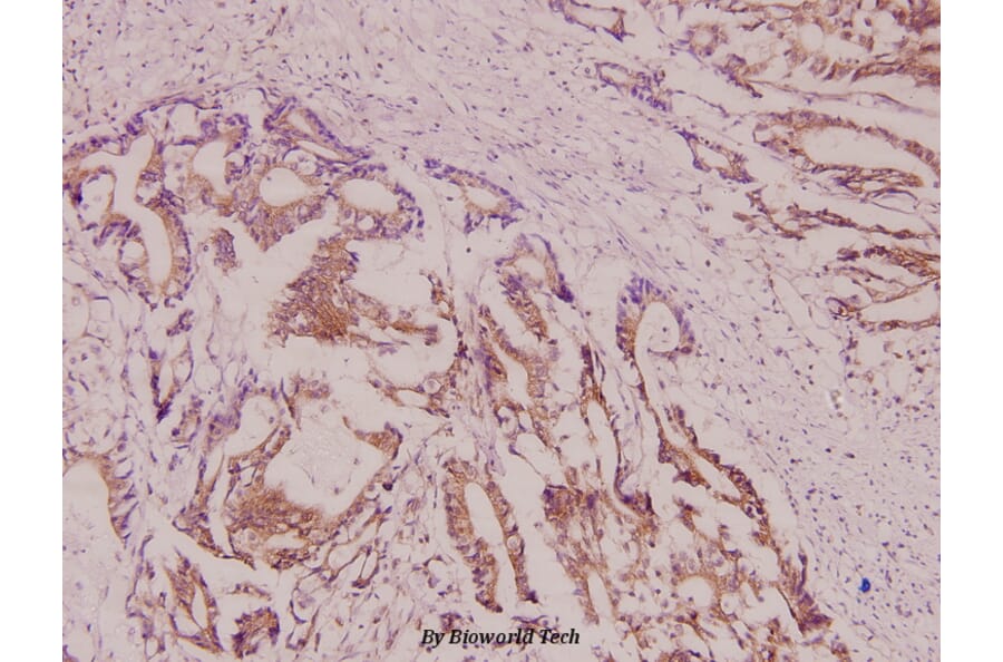 Anti-DAPK2 (R314) Antibody from Bioworld Technology (BS1628) - Antibodies.com