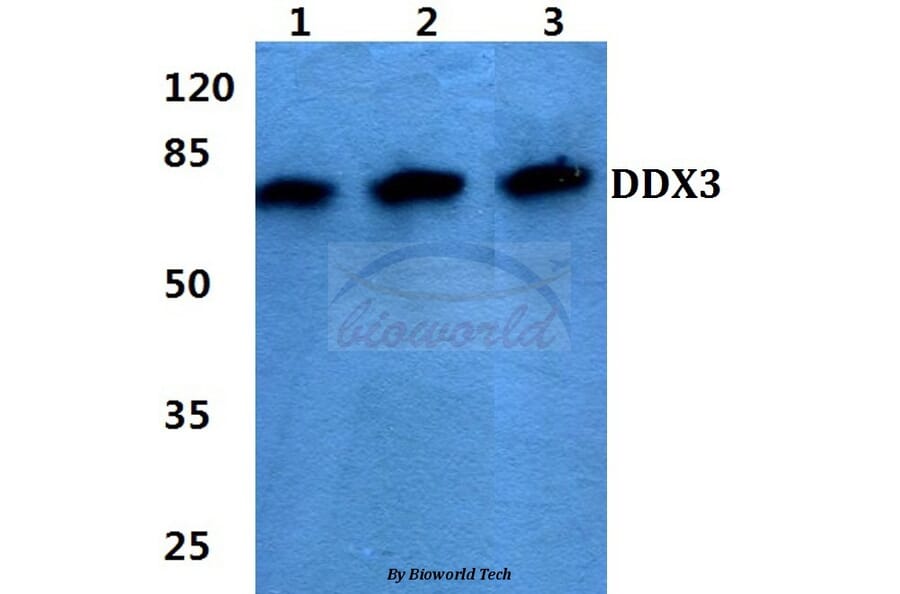 Anti-DDX3 (L318) Antibody from Bioworld Technology (BS1629) - Antibodies.com