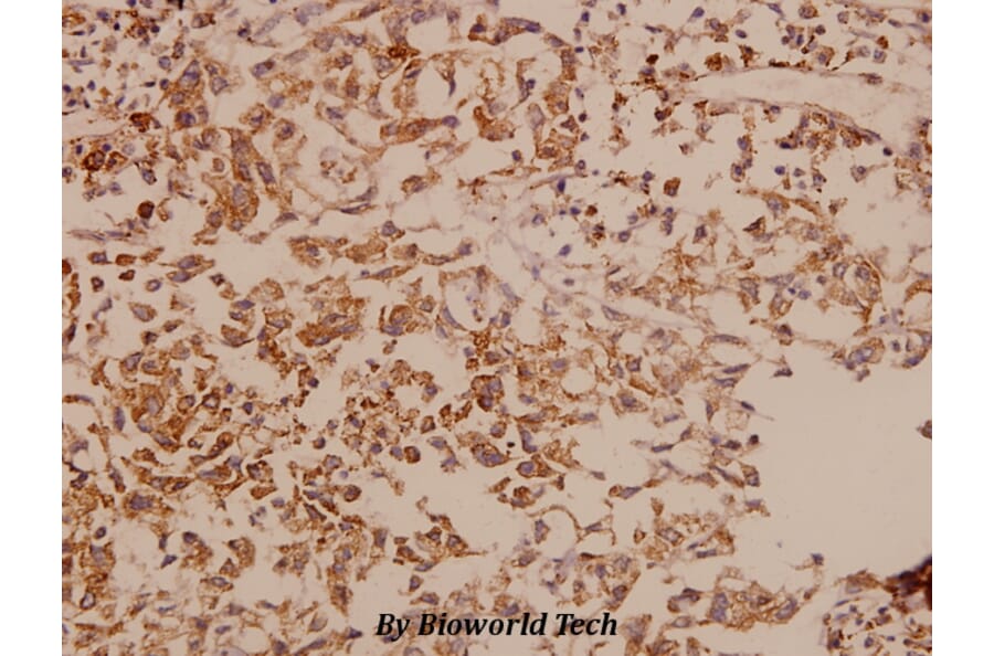 Anti-DDX3 (L318) Antibody from Bioworld Technology (BS1629) - Antibodies.com