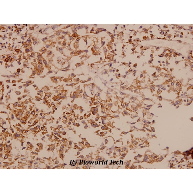 Anti-DDX3 (L318) Antibody from Bioworld Technology (BS1629) - Antibodies.com