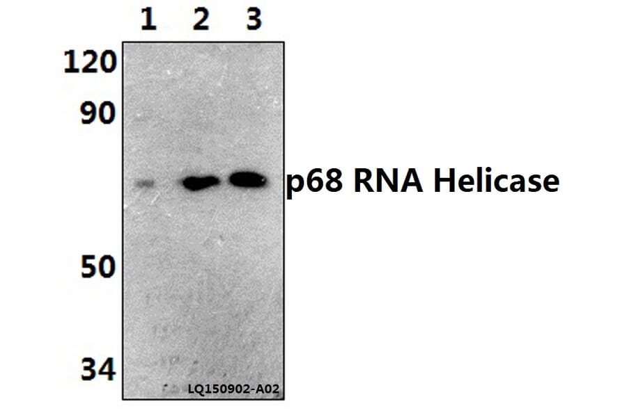 Anti-p68 RNA Helicase (N589) Antibody from Bioworld Technology (BS1630) - Antibodies.com