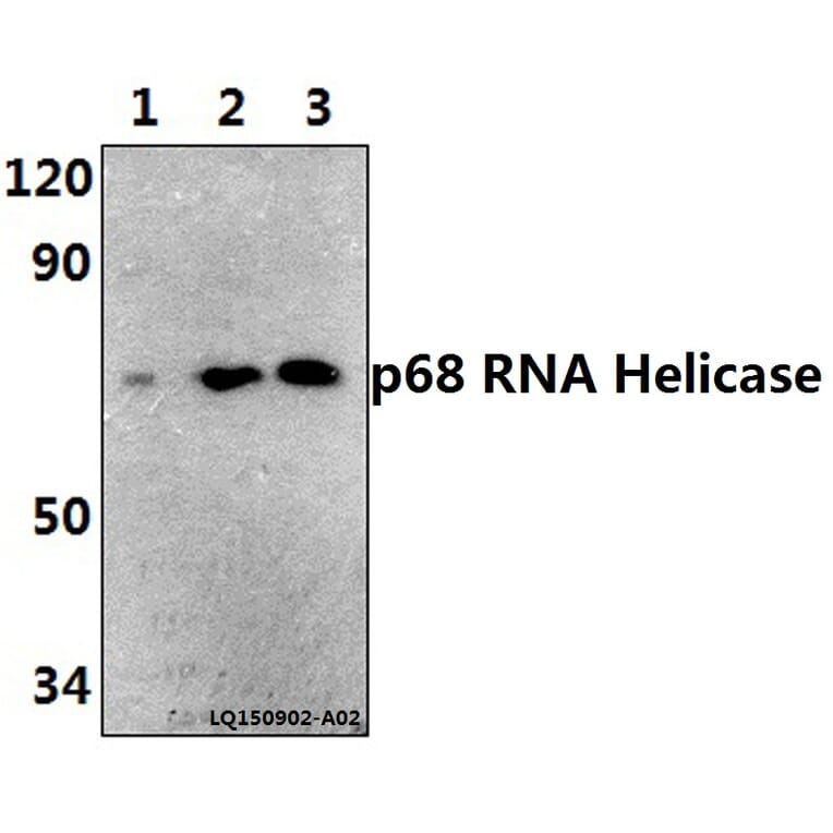 Anti-p68 RNA Helicase (N589) Antibody from Bioworld Technology (BS1630) - Antibodies.com