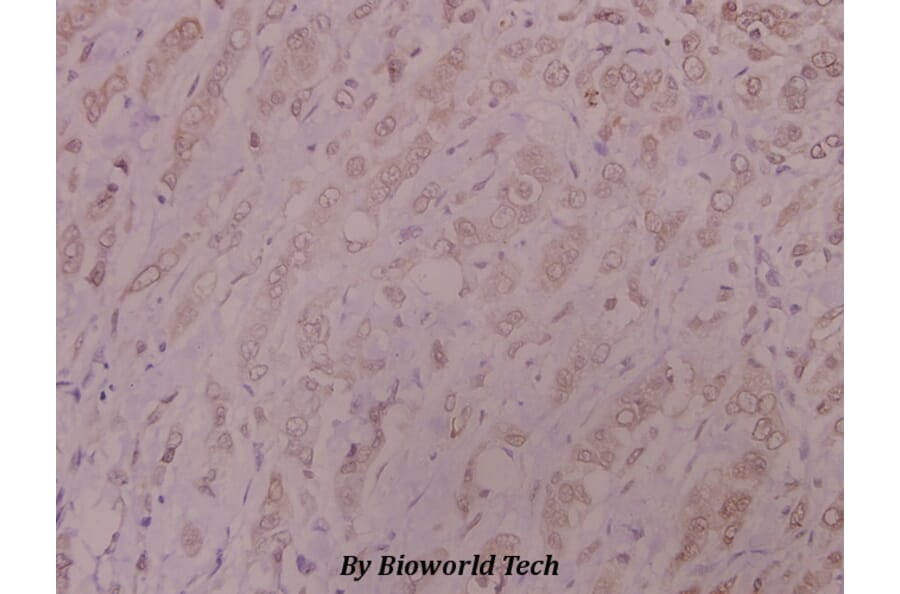 Anti-DNA-PK (Y2052) Antibody from Bioworld Technology (BS1634) - Antibodies.com