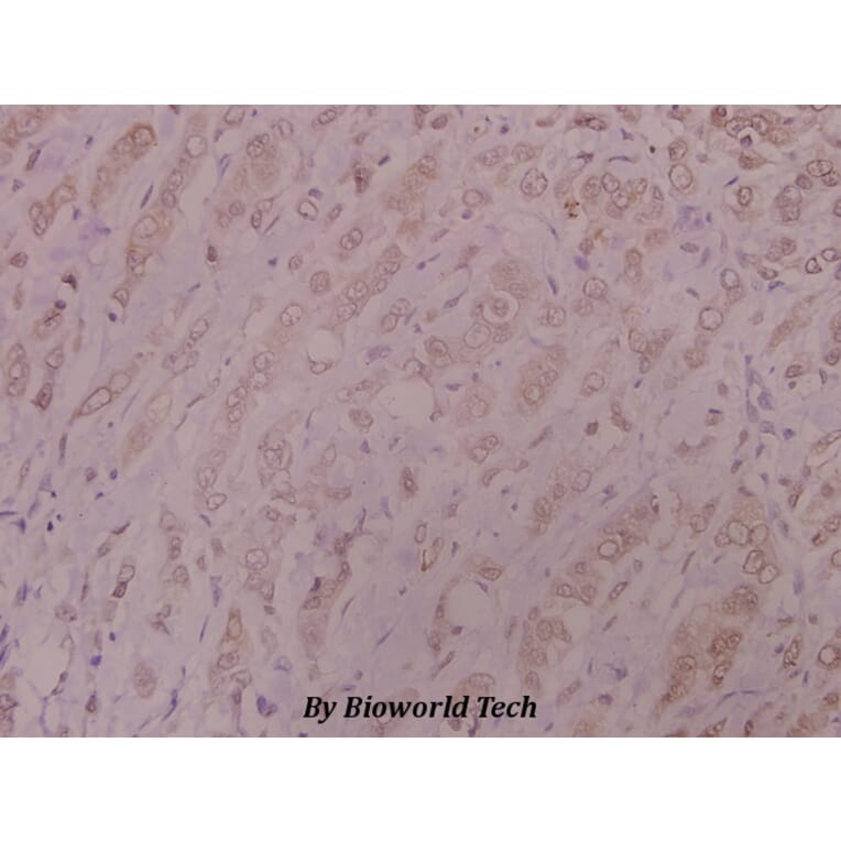 Anti-DNA-PK (Y2052) Antibody from Bioworld Technology (BS1634) - Antibodies.com