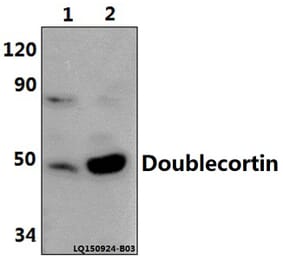 Anti-Doublecortin (K292) Antibody from Bioworld Technology (BS1635) - Antibodies.com