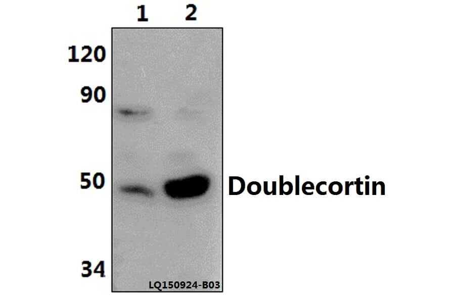 Anti-Doublecortin (K292) Antibody from Bioworld Technology (BS1635) - Antibodies.com