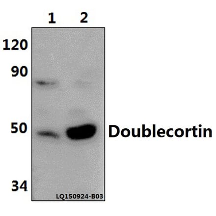 Anti-Doublecortin (K292) Antibody from Bioworld Technology (BS1635) - Antibodies.com